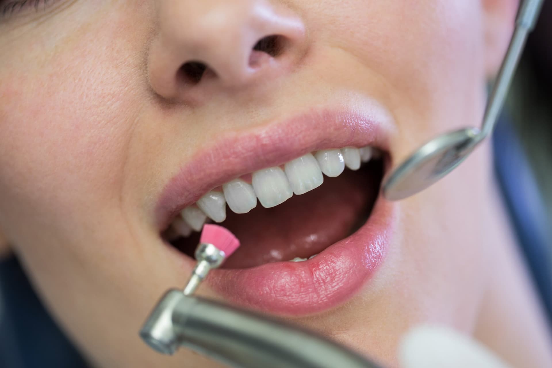 Dentalhygiene Behandlung
