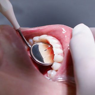 Periodontics lifedent