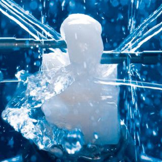 cerec all cermaic tooth reset lifedent