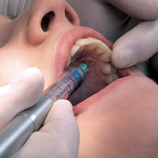 schmerzarme lifedent