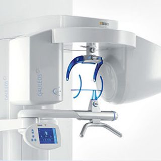 Volume tomography lifedent