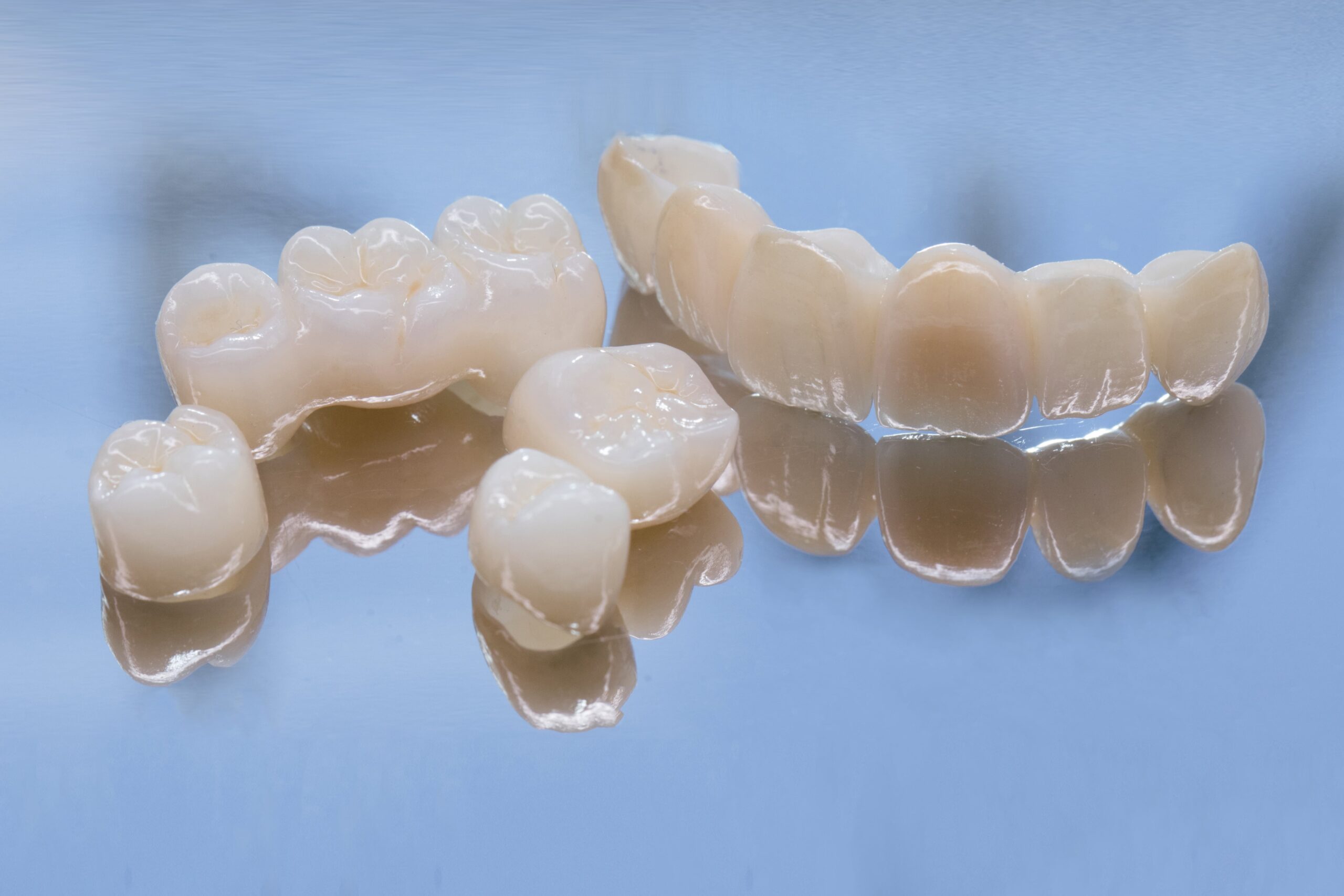 Dental Bridge Materials